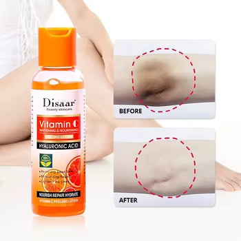 DISAAR Vitamin C Whitening & Nourishing Peeling Lotion